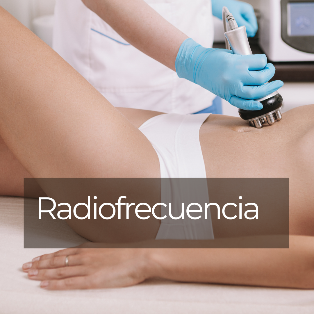 RADIOFRECUENCIA