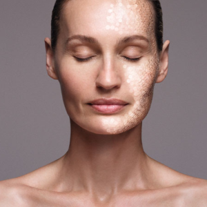 Mesopeel