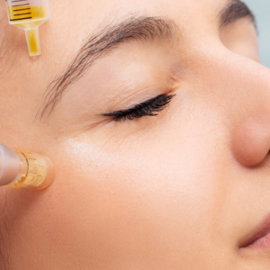 Microneedling